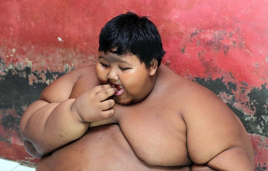 10岁胖娃成世界最重男孩 除了吃饭就是睡(1)