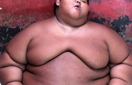 10岁胖娃成世界最重男孩 除了吃饭就是睡(3)