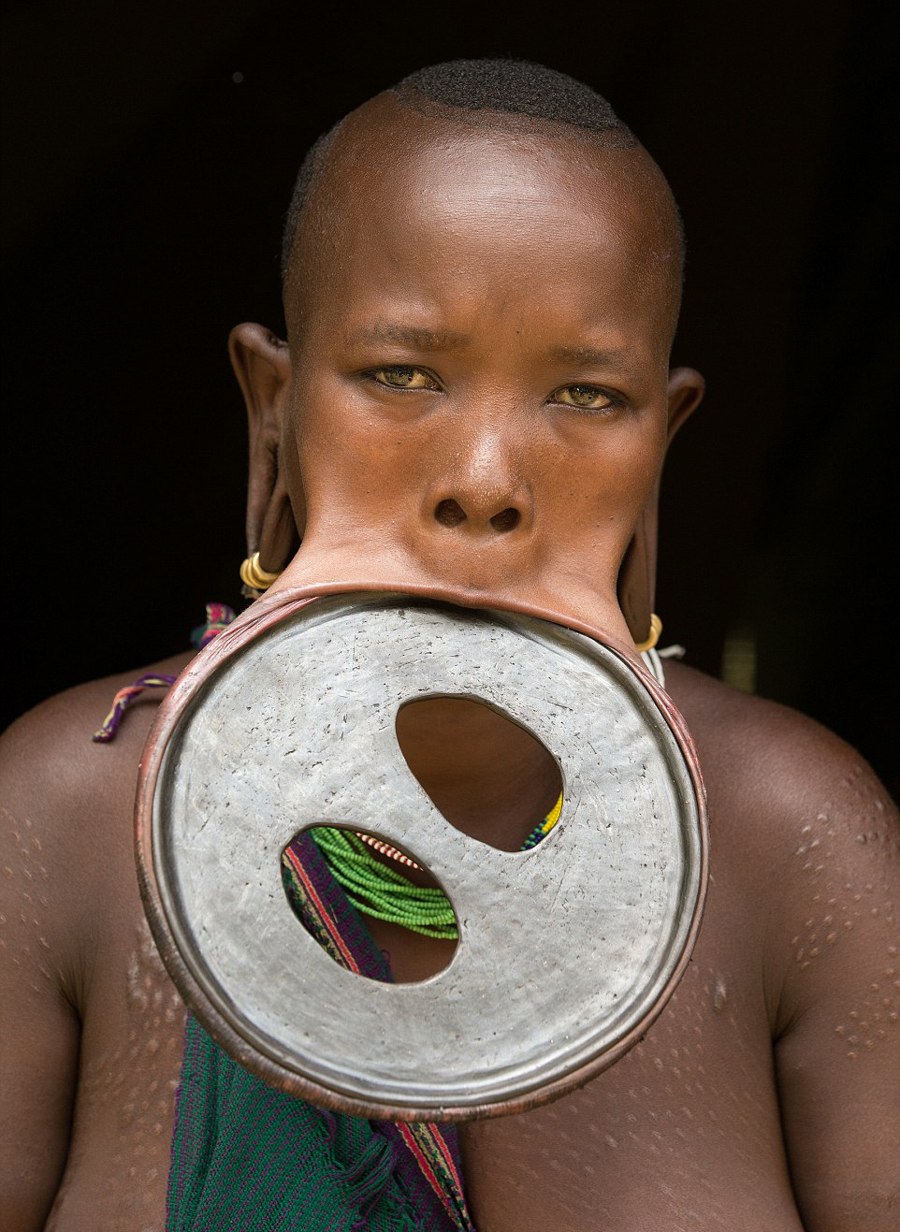 20岁女子阿塔耶·埃莉吉达格尼（Ataye Eligidagne）戴上世界上最大的唇盘，其周长达59.5厘米，直径19.5厘米。