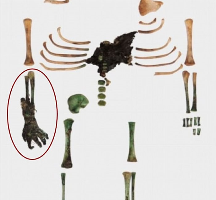 婴尸骸骨的右前臂及手部（红圈）呈木乃伊化。