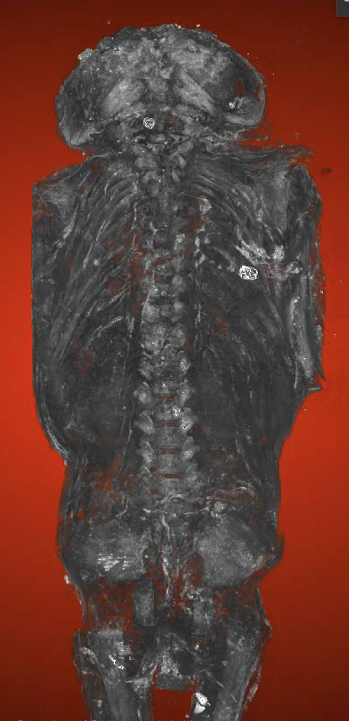 2100年历史的“鹞鹰”木乃伊实际上是有许多疾病的死胎