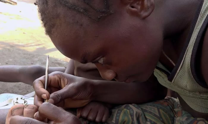 英国纪录片导演Livia Simoka深入刚果探访俾格米人：9岁“虫虫女王”专挖脚底沙蚤