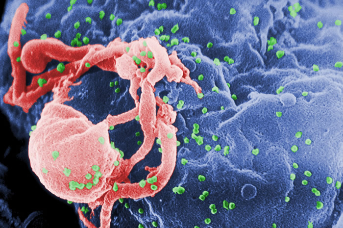 HIV病毒与艾滋病示意图