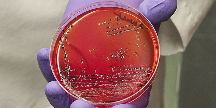 研究发现新型沙门氏菌对人类极为危险