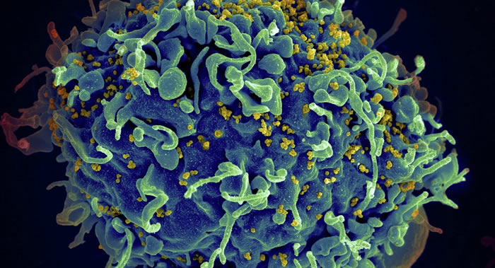 中俄科学家正在合作研究一种可治愈HIV（艾滋病病毒）感染新疗法