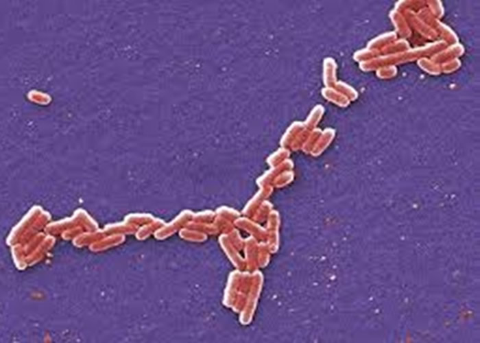 大肠杆菌对抗生素的抗药性已广泛传播。