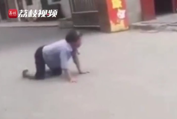 狂犬病发作？湖南省邵阳市老妇被狗咬伤10天后跪地爬行学狗叫