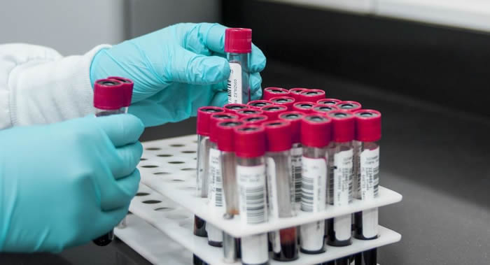 日本东芝公司开发出通过血液检测来诊断癌症的方法 准确率高达99%