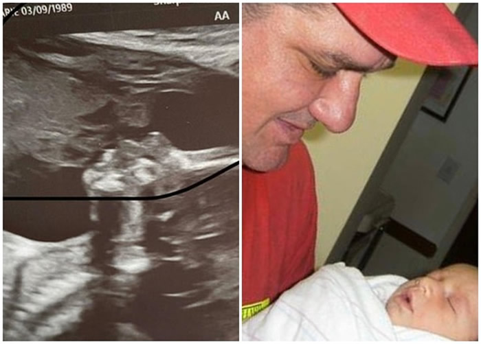 超声波照片（左图）酷似有人亲吻宝宝。右图为亡父早年拥抱长孙女。