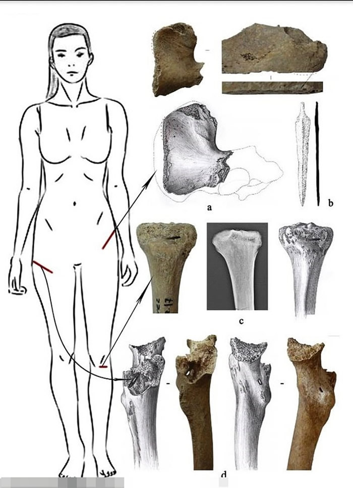 专家分析骸骨后认为女死者体格及肌肉非常发达。