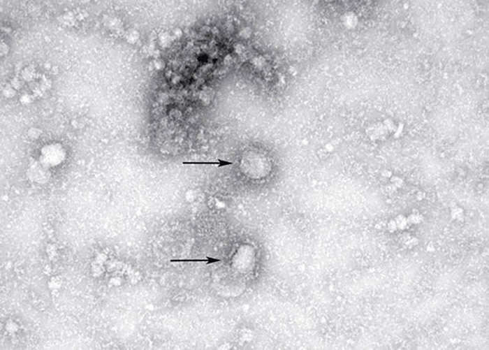 新型冠状病毒（2019-nCoV）引发的肺炎的有关起源、研究和疫苗的最新消息