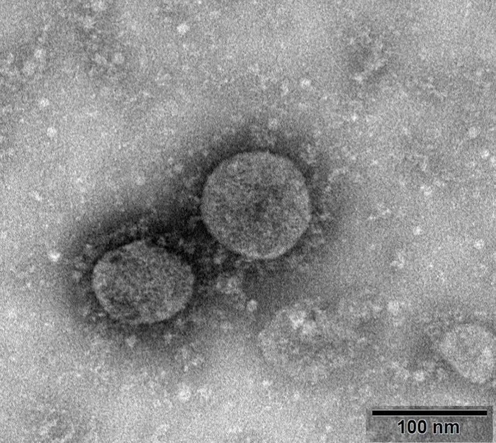 成功分离新型冠状病毒毒株 最快一个月可研制出疫苗
