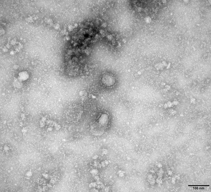 澳洲多尔蒂研究所科学家传称已经复制出新型冠状病毒
