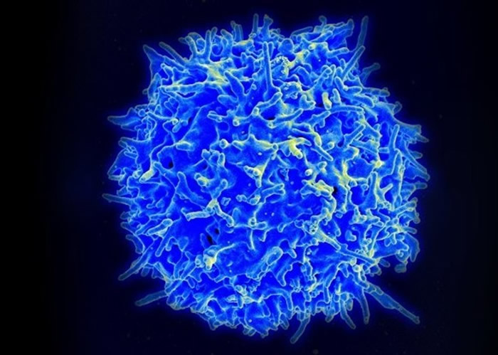人体巨噬细胞（图）将成为未来抗癌的新希望。