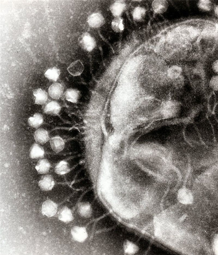 人类救星？英国细菌学家Ernest Hankin曾在印度恒河发现能杀灭霍乱菌的病毒“噬菌体”