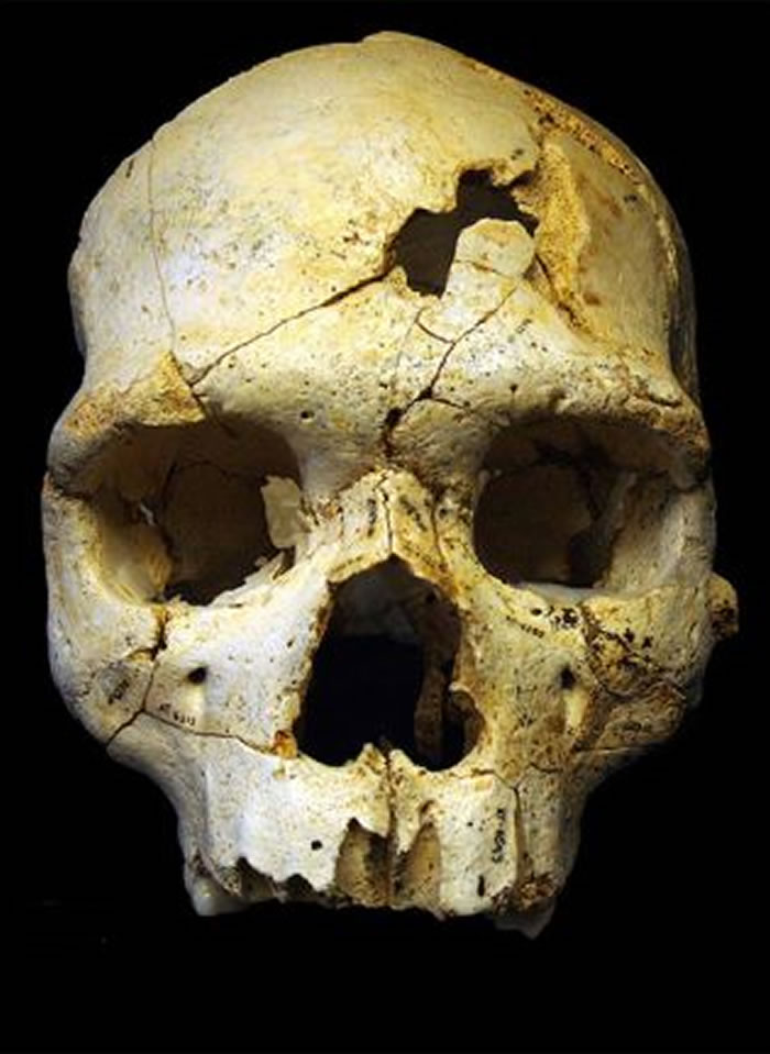 在西班牙Sima遗址出土的一个43万年前的头骨上，发现了两处可致命的颅骨骨折伤痕。这里被认为可能是迄今为止发现的最古老的人类丧葬遗迹。（图片来源: Van Le