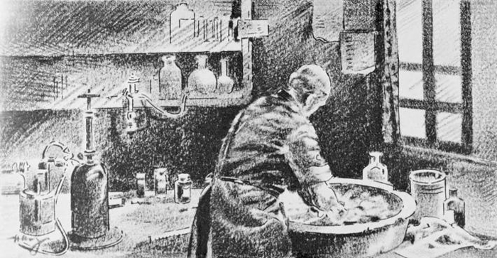 在这幅素描画中，塞默维斯正用次氯酸钙溶液清洗双手。 虽然他找出让医疗照护更安全的做法，但直到他在1865年逝世以前都未曾受到认同。 PHOTOGRAPH BY