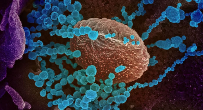 抗寄生虫药伊维菌素可阻止新冠病毒进入细胞核中 可能对治疗冠状病毒患者非常有效