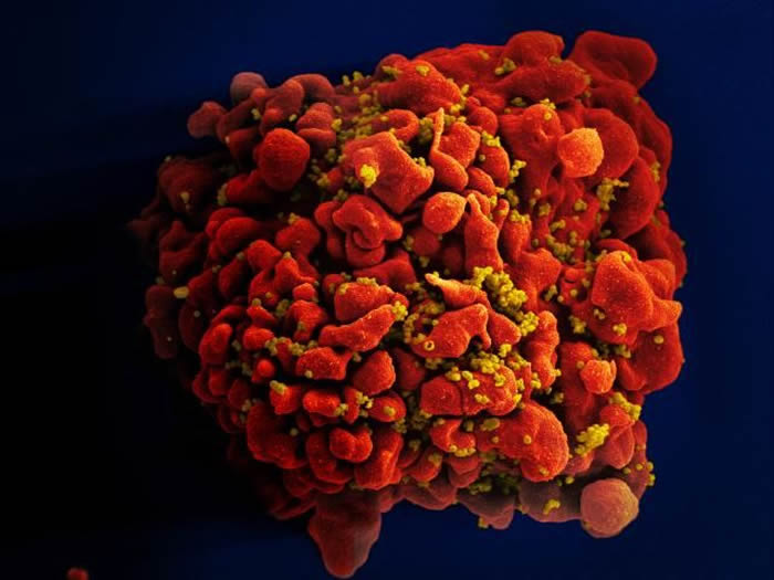 刚果民主共和国1966年的组织样本中发现已知最古老的近乎完整的HIV基因组