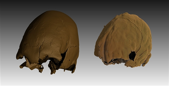 有意识的颅骨改形行为导致松花江人颅骨（左）和脑（右）严重变形。倪喜军研究团队 供图