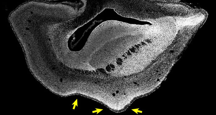 101日龄普通狨猴胎儿的大脑切片（Credit : Heide et al. / MPI-CBG）