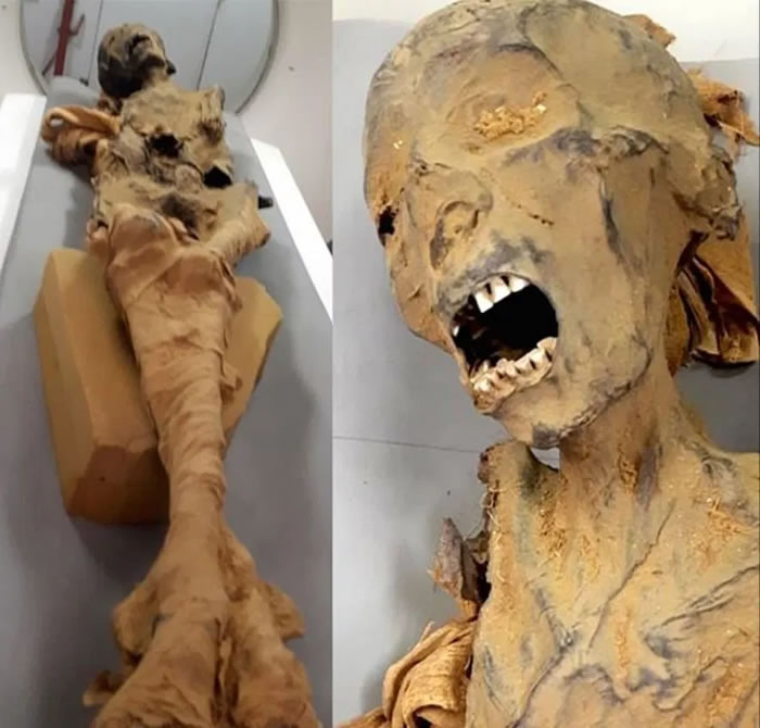 埃及1881年发现的代尔埃尔巴哈里皇家墓穴中3000年前“尖叫女人木乃伊”死于心脏病发