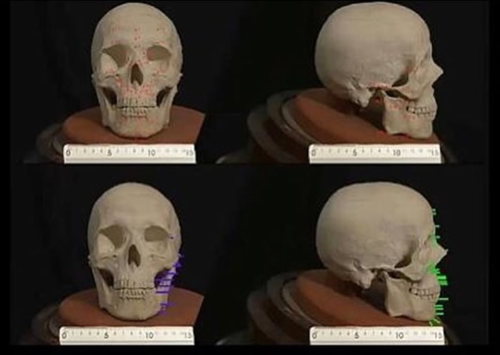 团队利用拉斐尔的头骨石膏模型重塑其脸容。