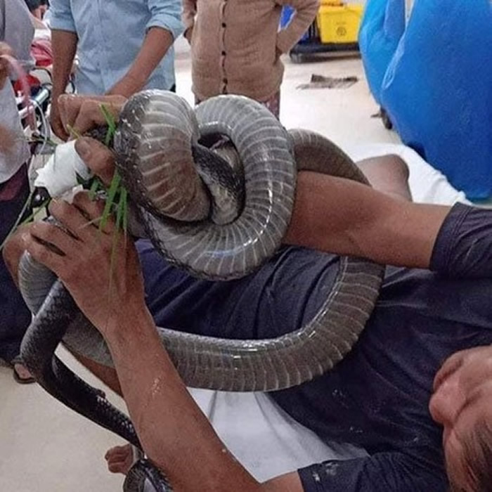 越南西宁省男子遭眼镜王蛇咬 入院时眼镜王蛇还死死缠在手上
