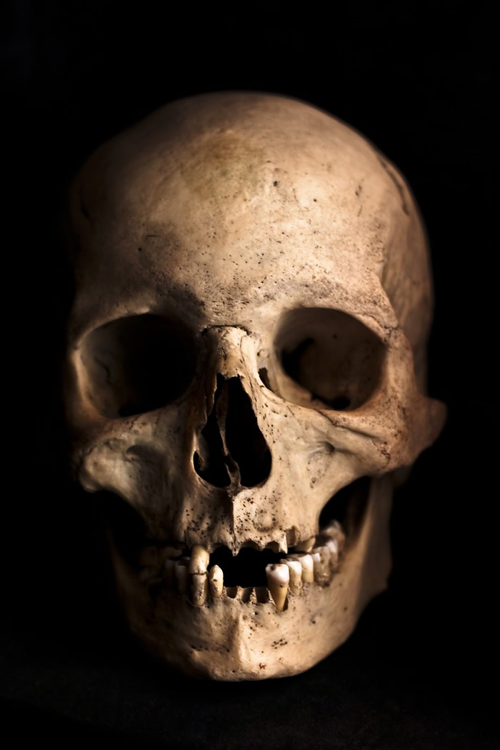 西班牙Dehesilla洞穴中发现生前曾接受过脑部手术的古代人类头骨