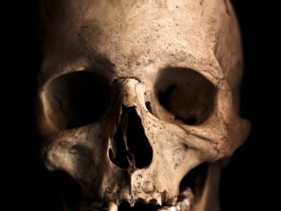 西班牙Dehesilla洞穴中发现生前曾接受过脑部手术的古代人类头骨
