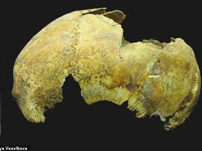 克里米亚出土青铜时代接受开颅手术的头骨 人类在5000年前或已拥有外科手术技术