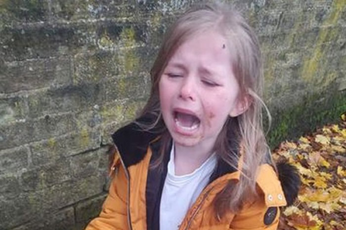英国约克郡哈利法克斯市5岁小女孩放学不小心跌倒惨吃狗屎