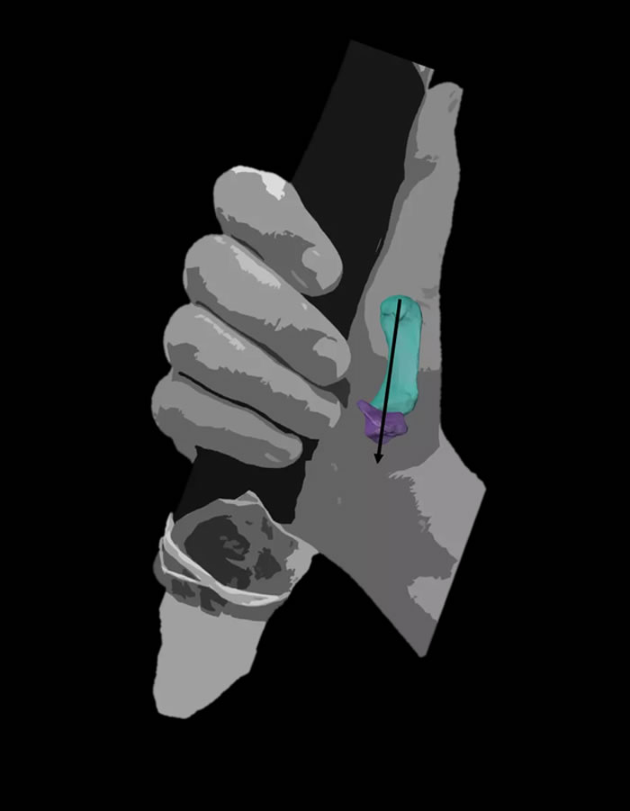 一个现代人展示的“力性抓握”，尼安德特人在抓握人造工具时可能就是以这种方式。这样抓握时，需用拇指的指向力将工具握在手指和手掌间。图片来自Ameline Bard