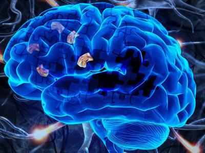 约翰·霍普金斯大学科学家发现硫化氢可以保护衰老的脑细胞 防止患上阿尔茨海默症
