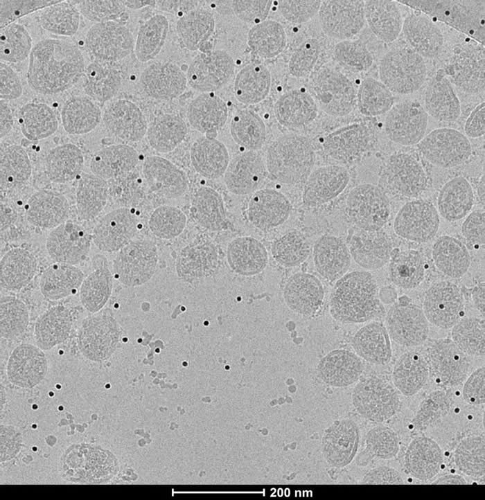 经多聚甲醛灭活后的新冠病毒冷冻电镜图片（李赛实验室供图）