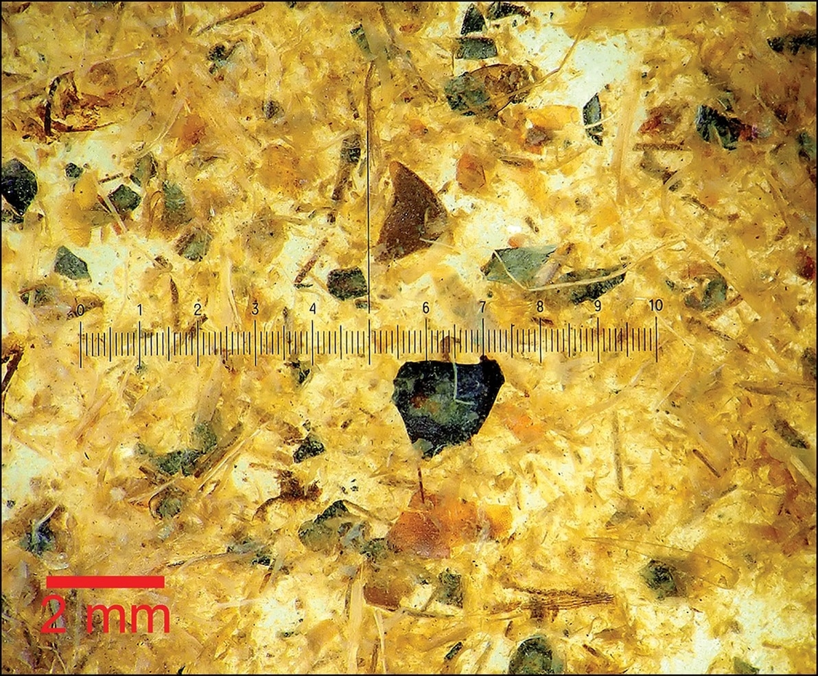 显微镜下的图伦男子肠胃内容物。 PHOTOGRAPH BY P.S. HENRIKSEN, THE DANISH NATIONAL MUSEUM