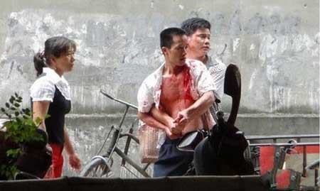 广西柳州飙血哥事件,头破血流能要血拼到底