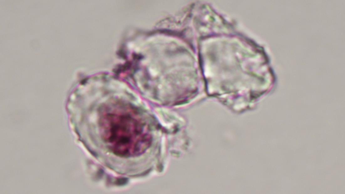 尾羽龙腿骨软骨细胞的显微照片。其中一个细胞中还有经过染色而显示出的细胞核，以及暗色的细丝状染色质。