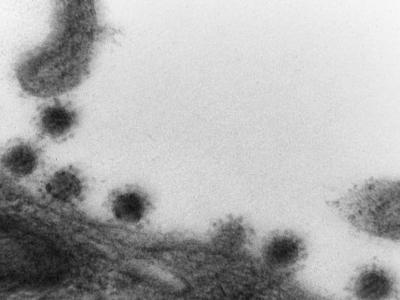 科学家认为在日本流行传播的新冠病毒德尔塔毒株可能会不断变异直到“自我灭绝”