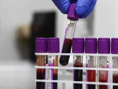 科学家发现一种找到血液中癌细胞的有效方法