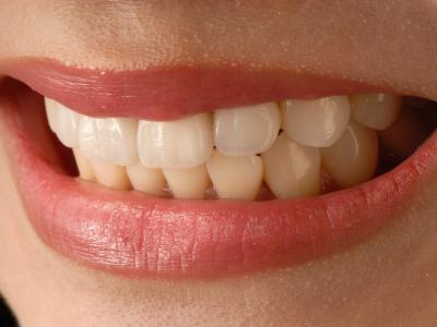 英国研究人员发现牙龈疾病与患心血管和自身免疫性疾病的风险增加有关
