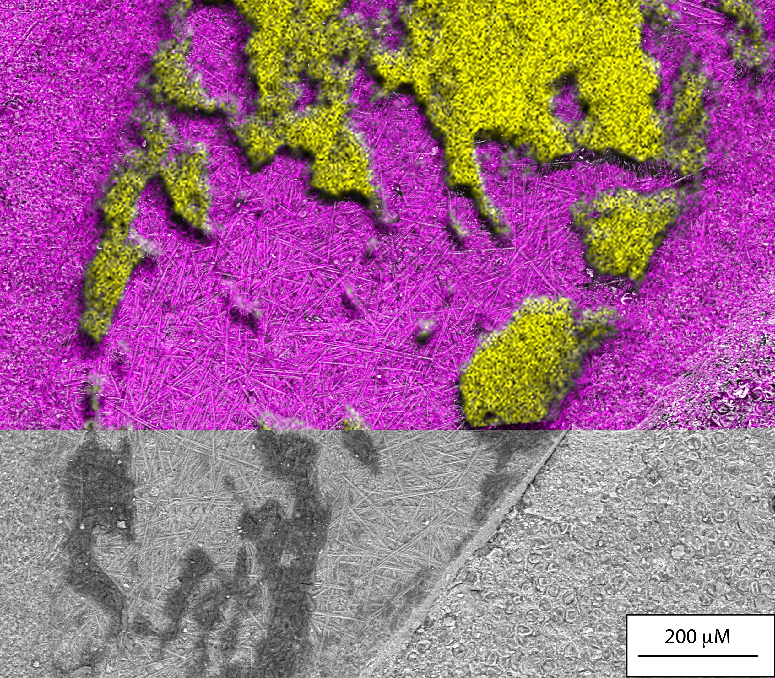 蜘蛛腹部化石的扫描电子图像显示了化石上的黑色聚合物和两种微藻的存在：化石上的直线硅藻垫和周围基质中分散的中心硅藻。该图像被硫（黄色）和硅（粉色）的化学图所覆盖，