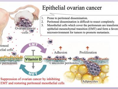 《Matrix Biology》杂志：维生素D能帮助抵御致命的卵巢癌